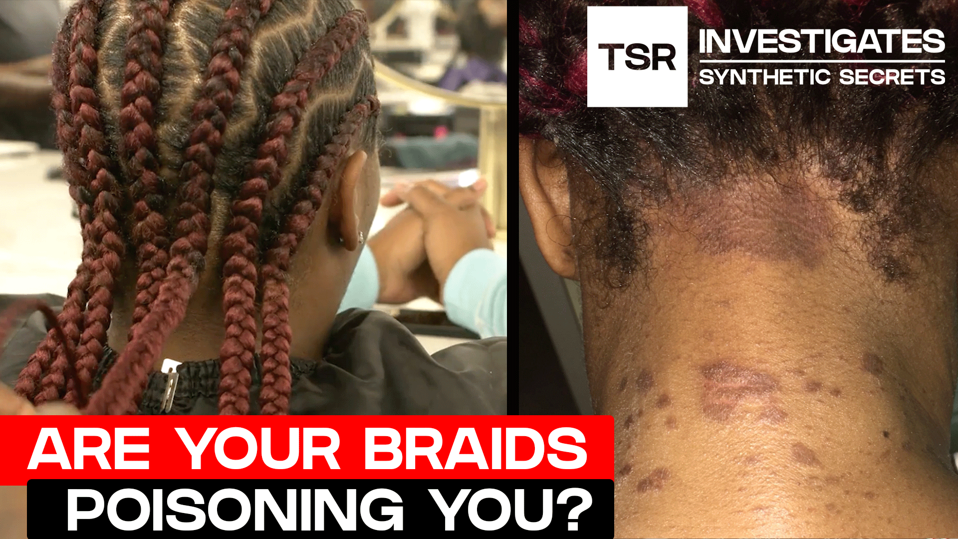 Could Your Braids Be Poisoning You? Inside The Toxic Synthetic Hair Investigation | TSR Investigates